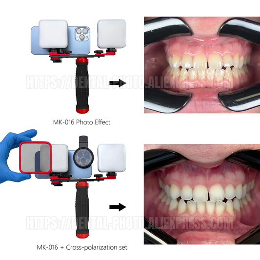 Mini LED Ring Light for Mobile Photography – Pro Lighting for Makeup, Nails & Macro Shots